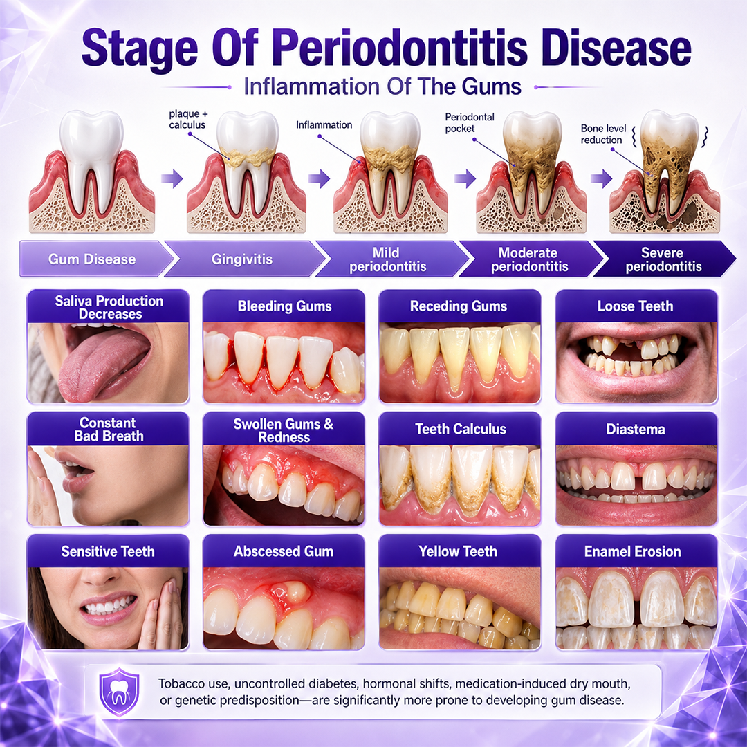 Common gum concerns